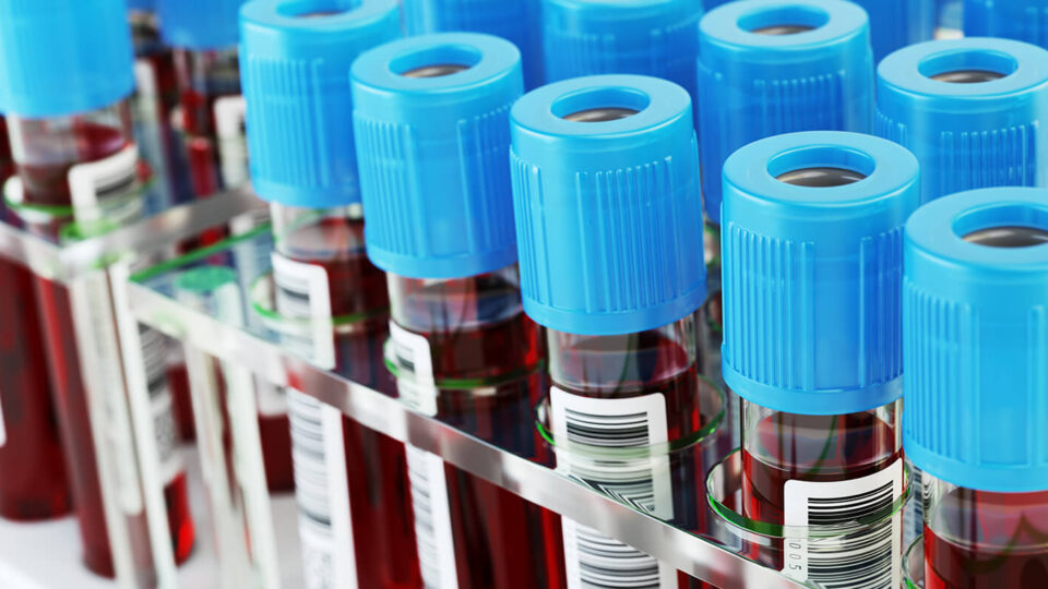 MultidrugResistant HIV1 Westat Helps Deliver a Treatment Option Westat